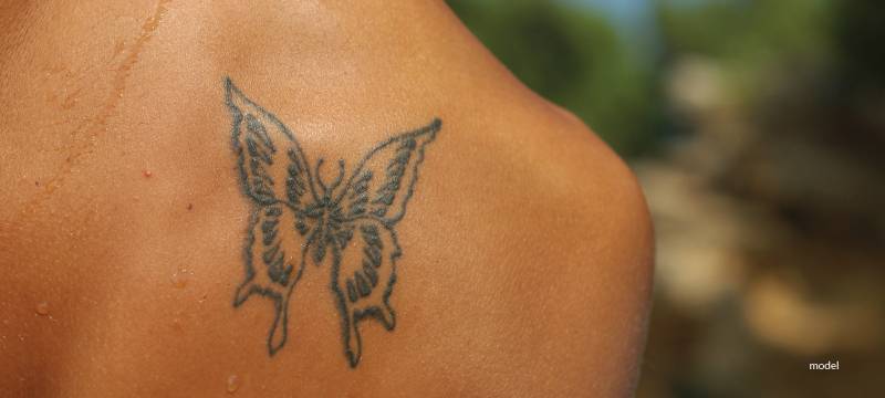 picosure tattoo removal