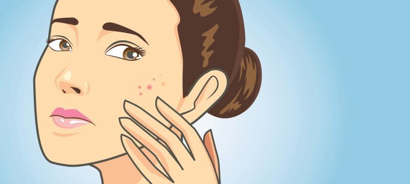 animation clog pores