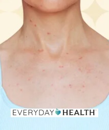 Everyday Health