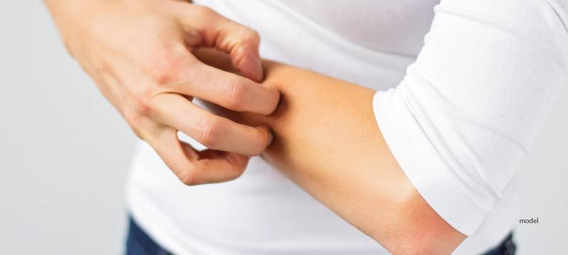 skin rashes