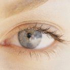brow lift recovery
