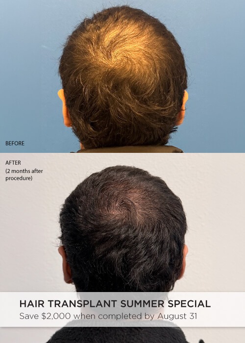 ghk cu before and after men reddit begins with consistency. Our 10% formula is engineered for deep absorption to support scalp health and visible density GHK-CU Before and After Pictures