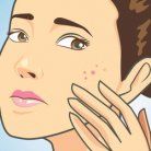 pop pimple