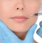 bruising after botox