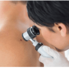 cancer treatment