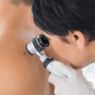 mohs surgery