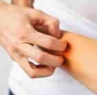 skin rashes