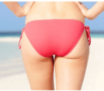 image showing cellulite free buttocks