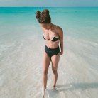 about coolsculpting elite