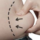 love handles close up