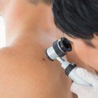 lipoma