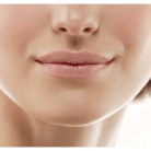 lip filler