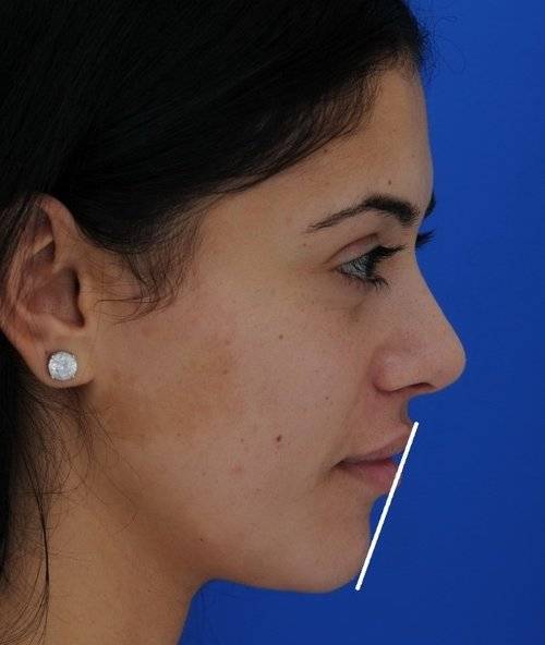 ideal facial profile