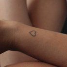 how tattoo removal works