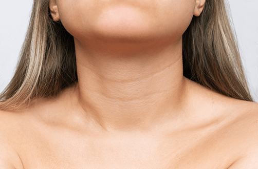 neck lines