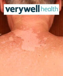 Verywell Health