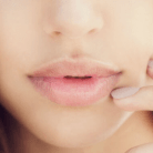 recovery from lip implant