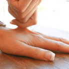 crepey skin treatments