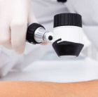 cyst treatments