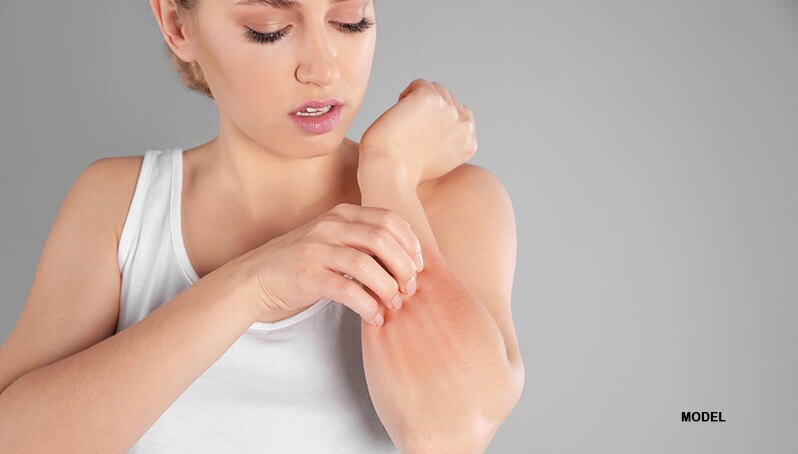 woman itching forearm