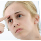 acne issues