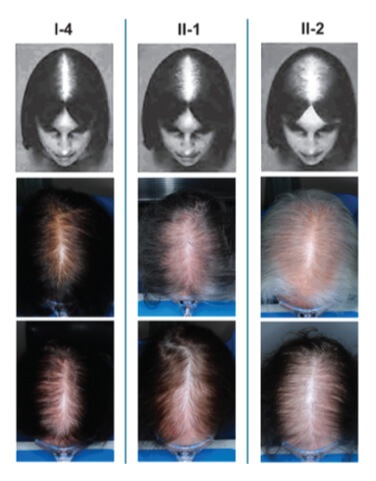 female hair image
