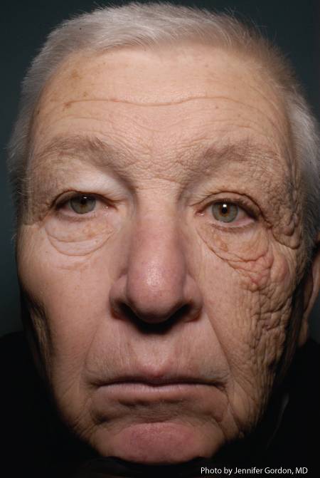 sun aging photo