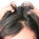scalp woman