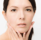 facelift