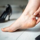 blister
