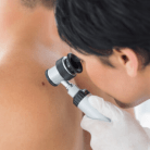 skin cancer dangers
